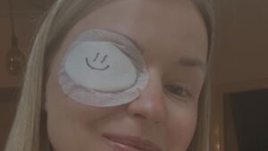 Anastasia⁢ Kuzmina Operata Occhio Come Sta
